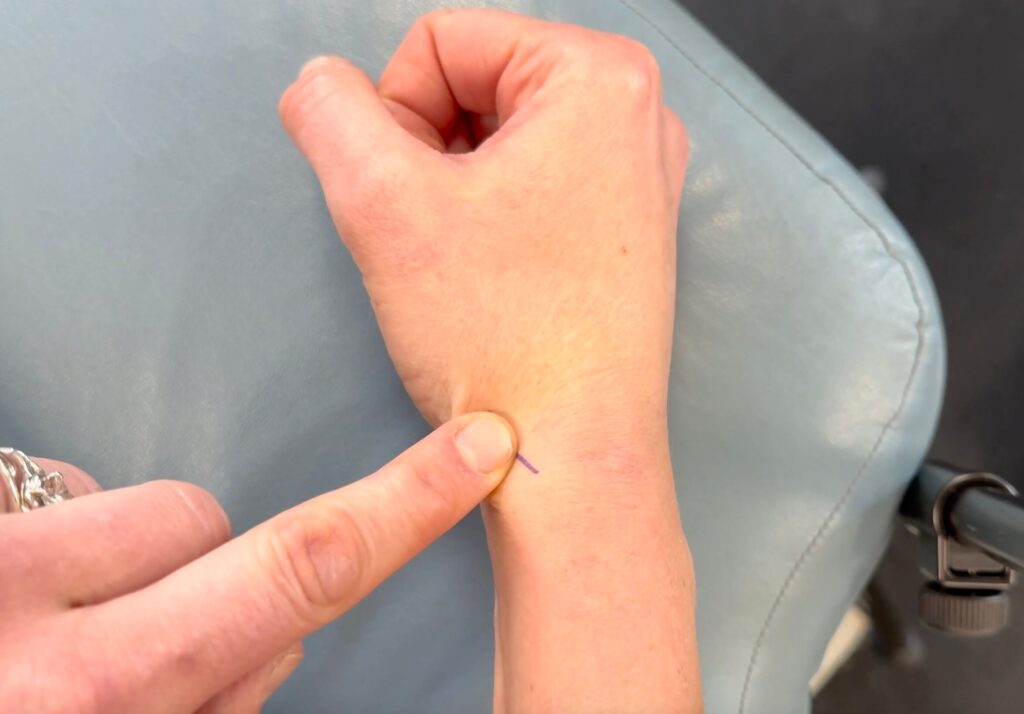 Lightly using 1 finger in a circular motion to break up scar tissue on the inside of the right wrist